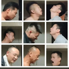 xqalbot